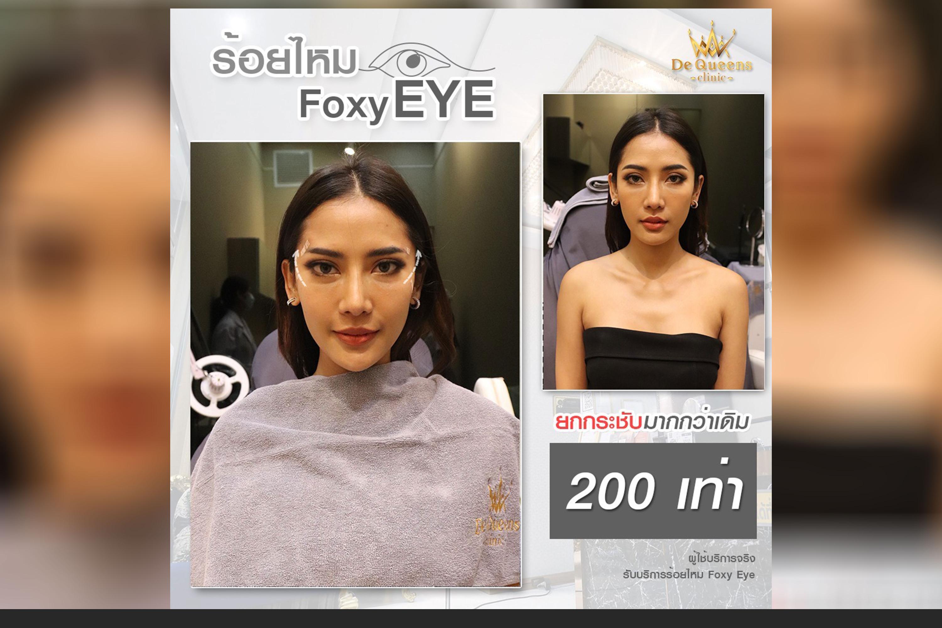 Foxy Eyes