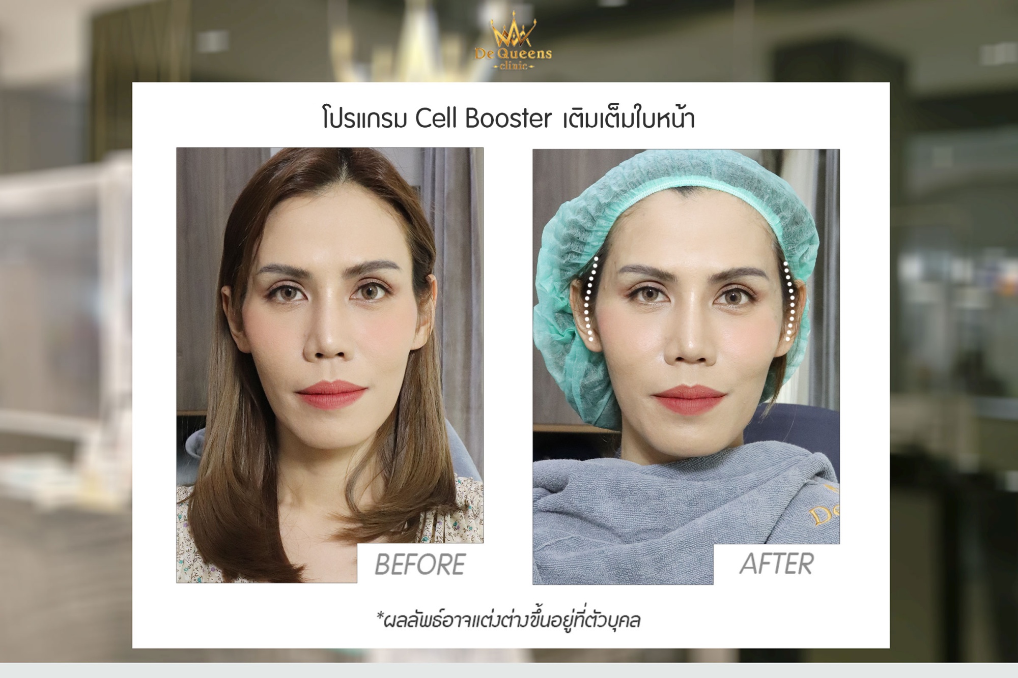 4D Cell Booster
