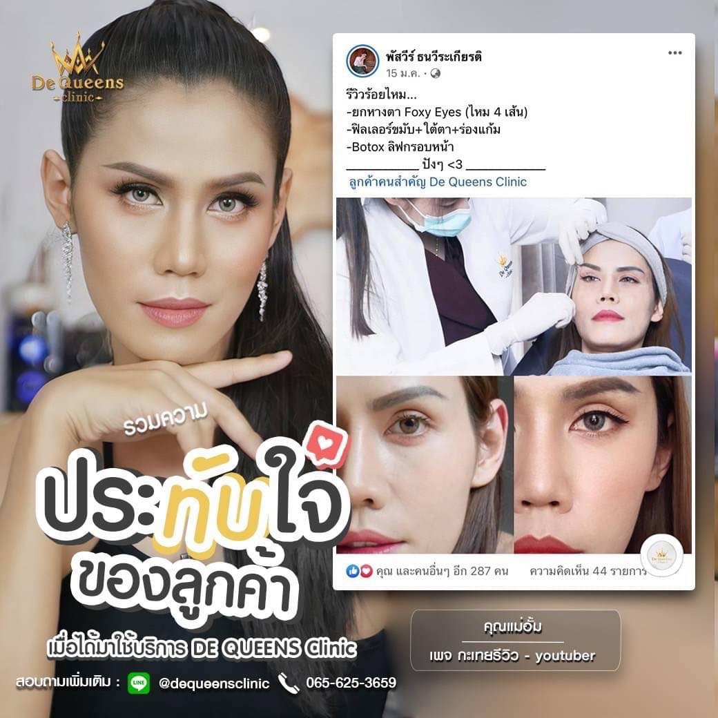 Foxy Eyes ปรับลุคดวงตาให้สวยคม ทำวิธีไหนได้บ้าง?