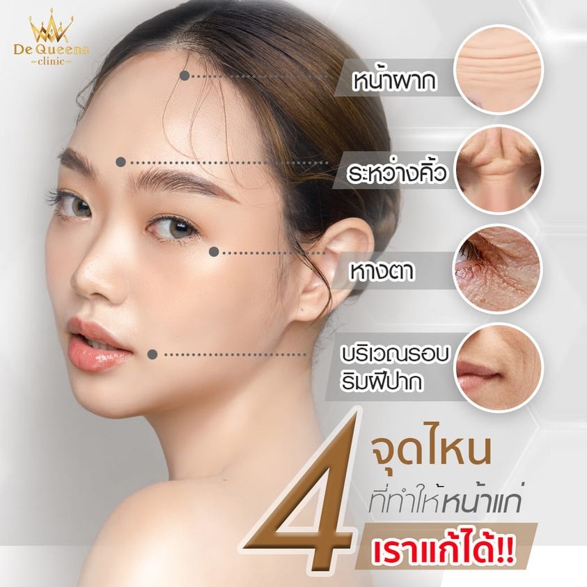 อายุเพิ่มขึ้น ริ้วรอยร่องลึก มาเพียบ! ฉีดโบลดริ้วรอยช่วยได้!