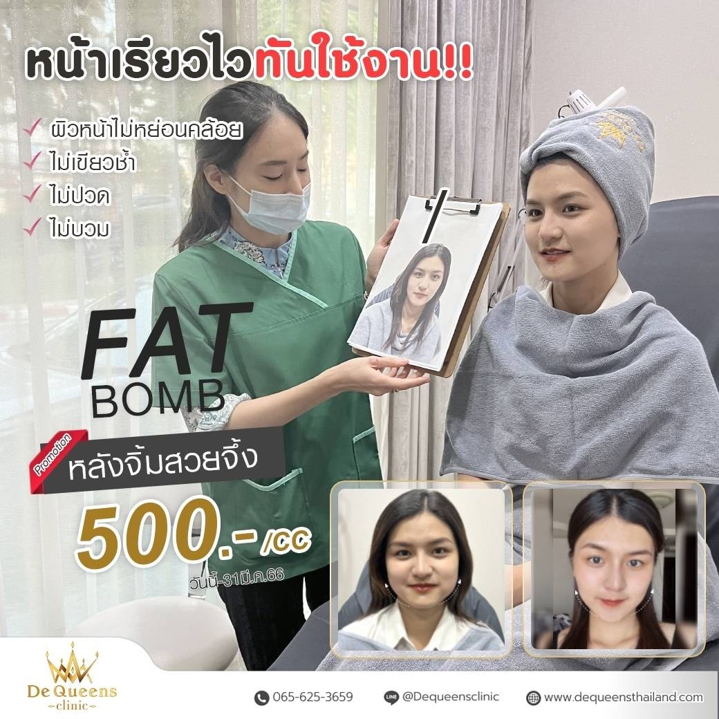 Meso Fat ทางเลือกความสวย เพื่อรูปร่างในฝัน