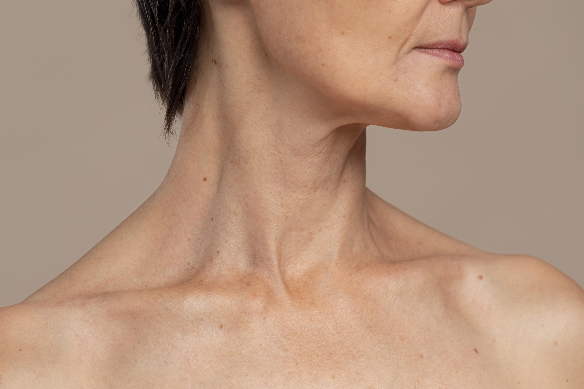 หนอกคอ (Buffalo Hump) คืออะไร รักษาอย่างไรได้บ้าง?