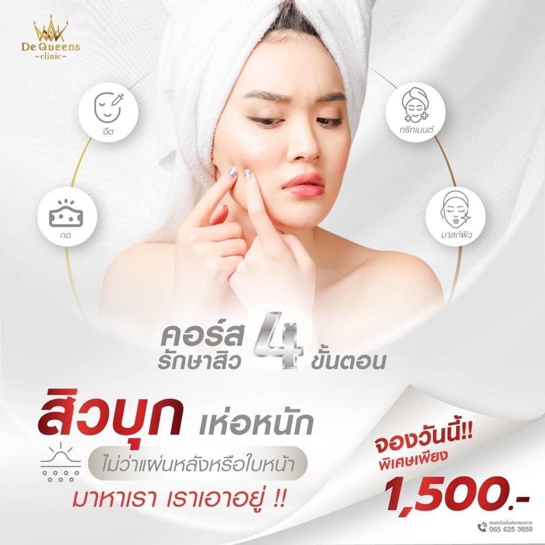 จบปัญหาสิว เผยผิวเนียนใส ด้วยโปรแกรมรักษาสิว 4 ขั้นตอน