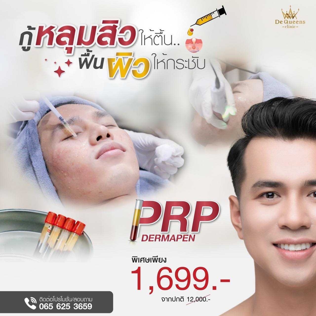 PRP Dermapen