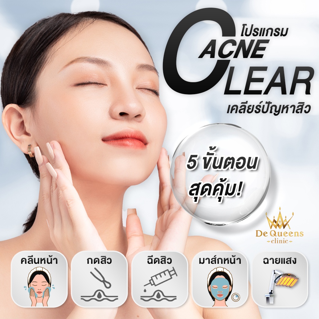 รักษาสิวชลบุรี เพชรบุรี คลีนหน้า กดสิว ฉีดสิว มาส์กหน้า ฉายแสง Acne clear