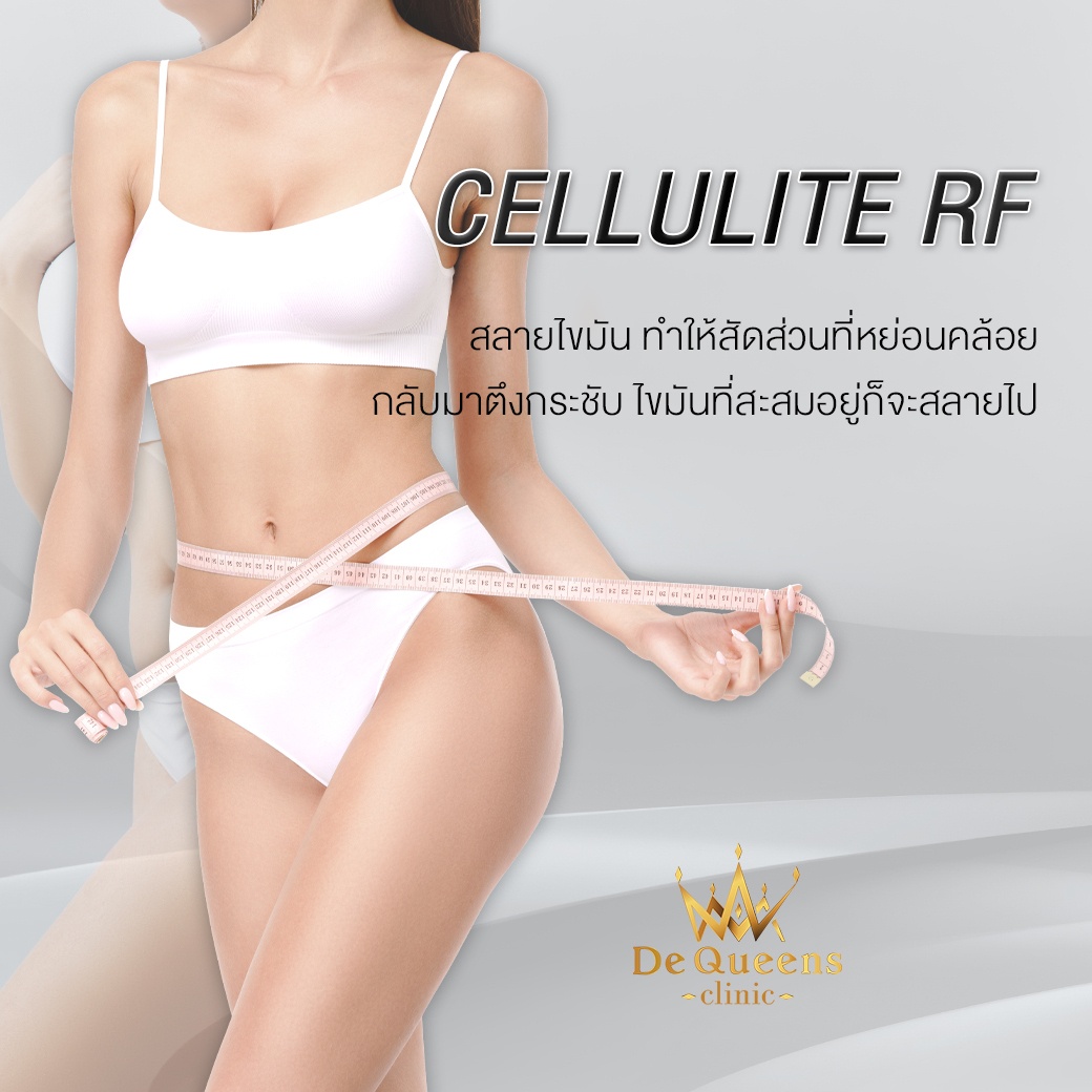 สลายไขมันส่วนเกินด้วย Cellulite RF