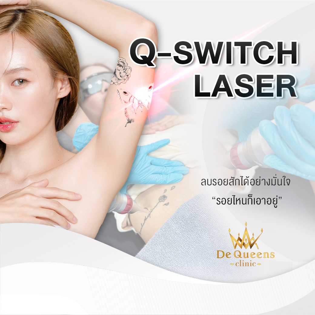ลบรอยสัก ด้วย Q-Switch Laser ลบรอยสัก ชลบุรี เพชรบุรี