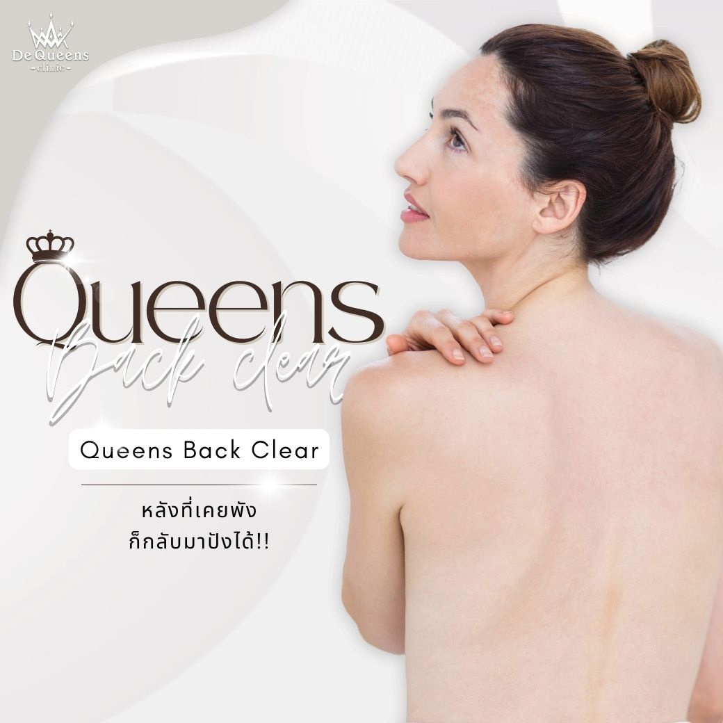 รักษาสิวที่หลัง รักษารอยสิวที่หลัง Queens Back Clear De Queens ชลบุรี เพชรบุรี