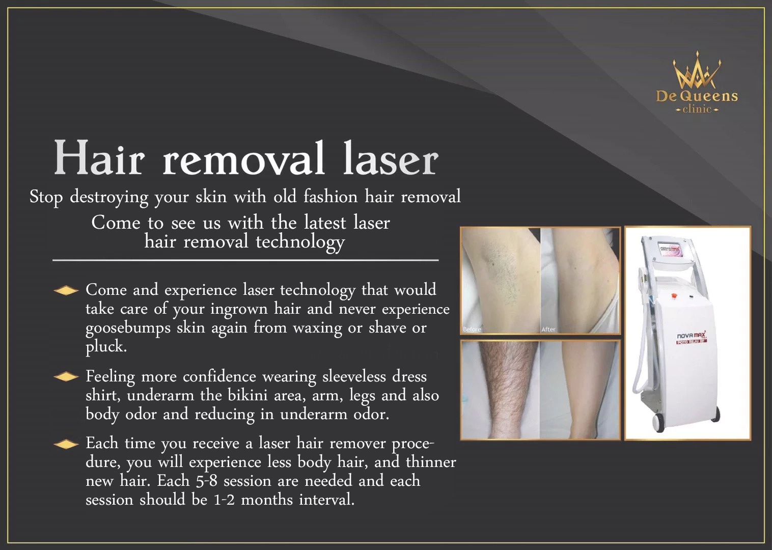 Hair removal laser