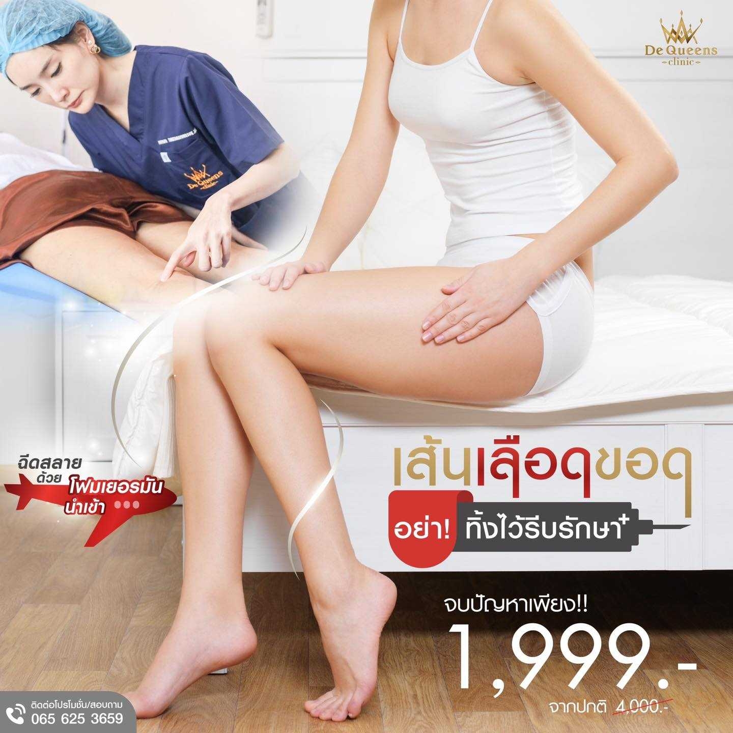 รักษาเส้นเลือดขอด ชลบุรี เพชรบุรี  1,999 บาท จำนวนจำกัด