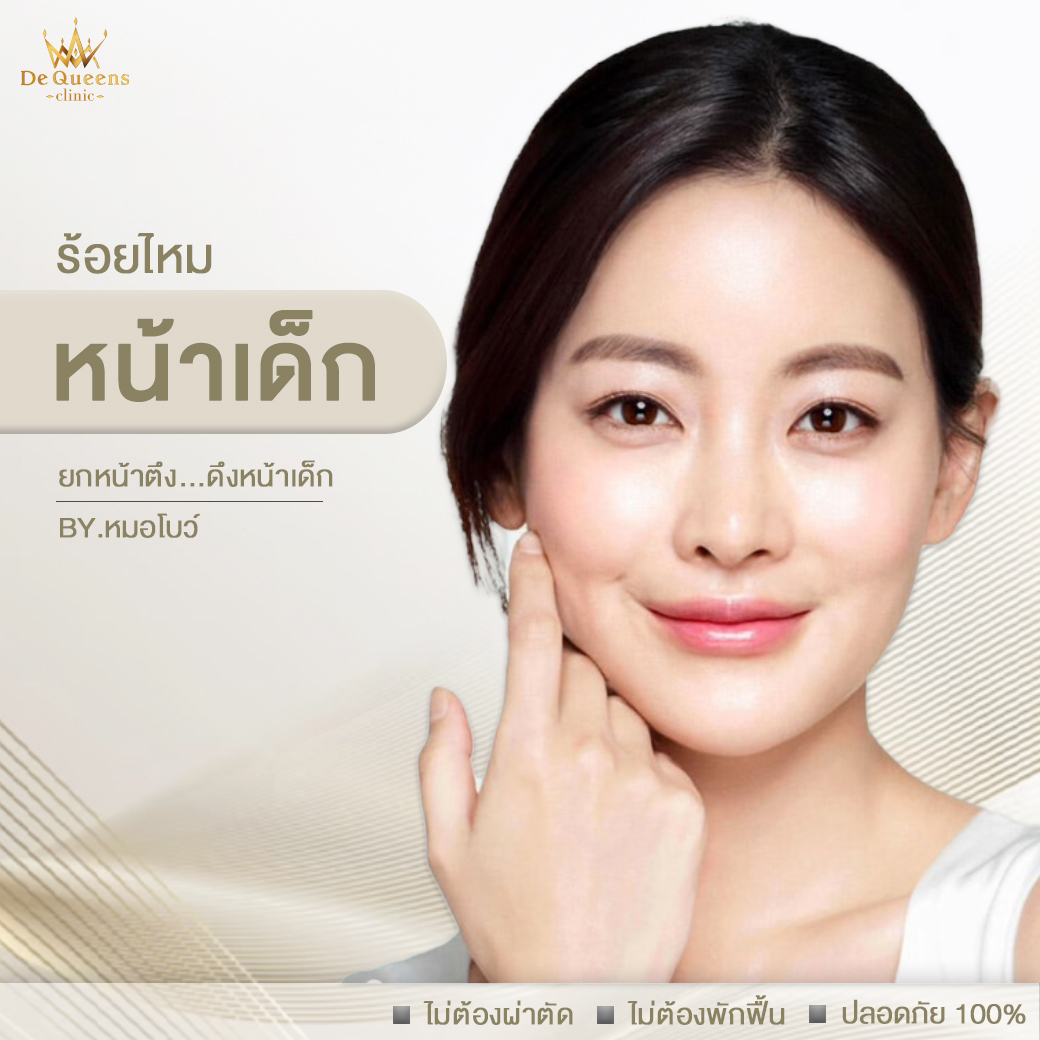 ร้อยไหมหน้าเด็ก