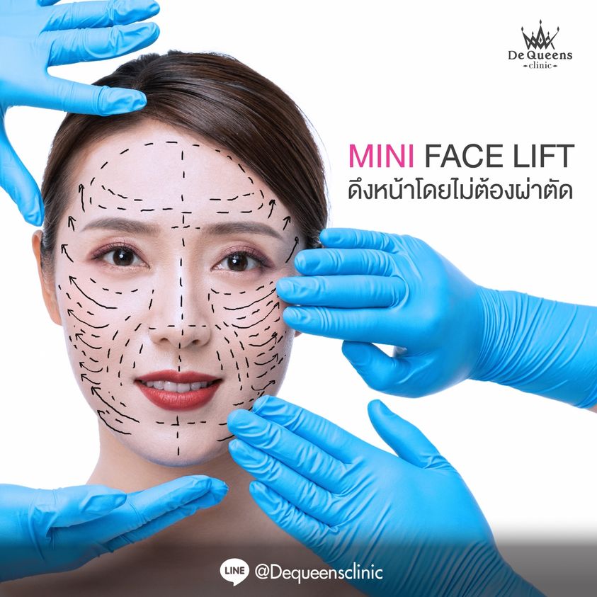 ร้อยไหม รอยบุ๋ม รอยนูน ที่เกิดหลังจากการร้อยไหมคืออะไร