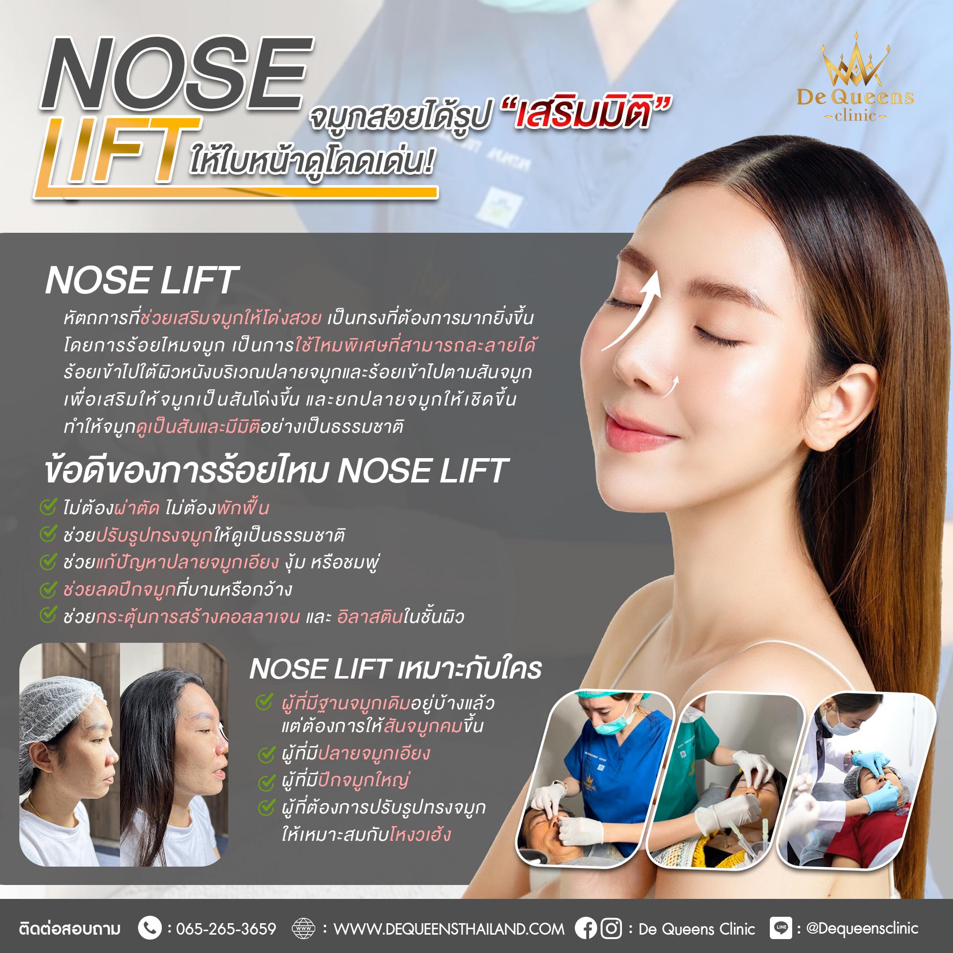 ทำ Nose Lift ดียังไง เหมาะกับใคร