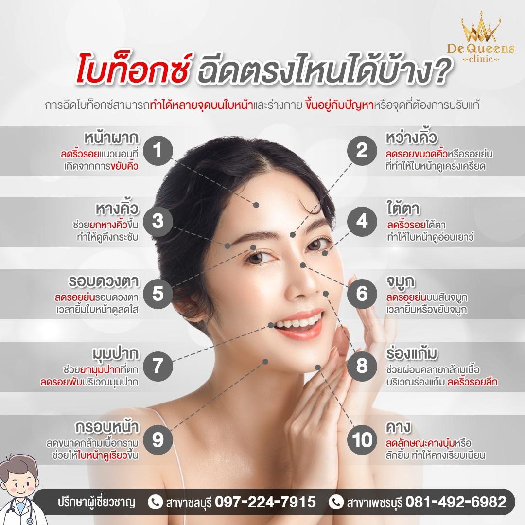 โบท็อกซ์ฉีดตรงไหนได้บ้าง