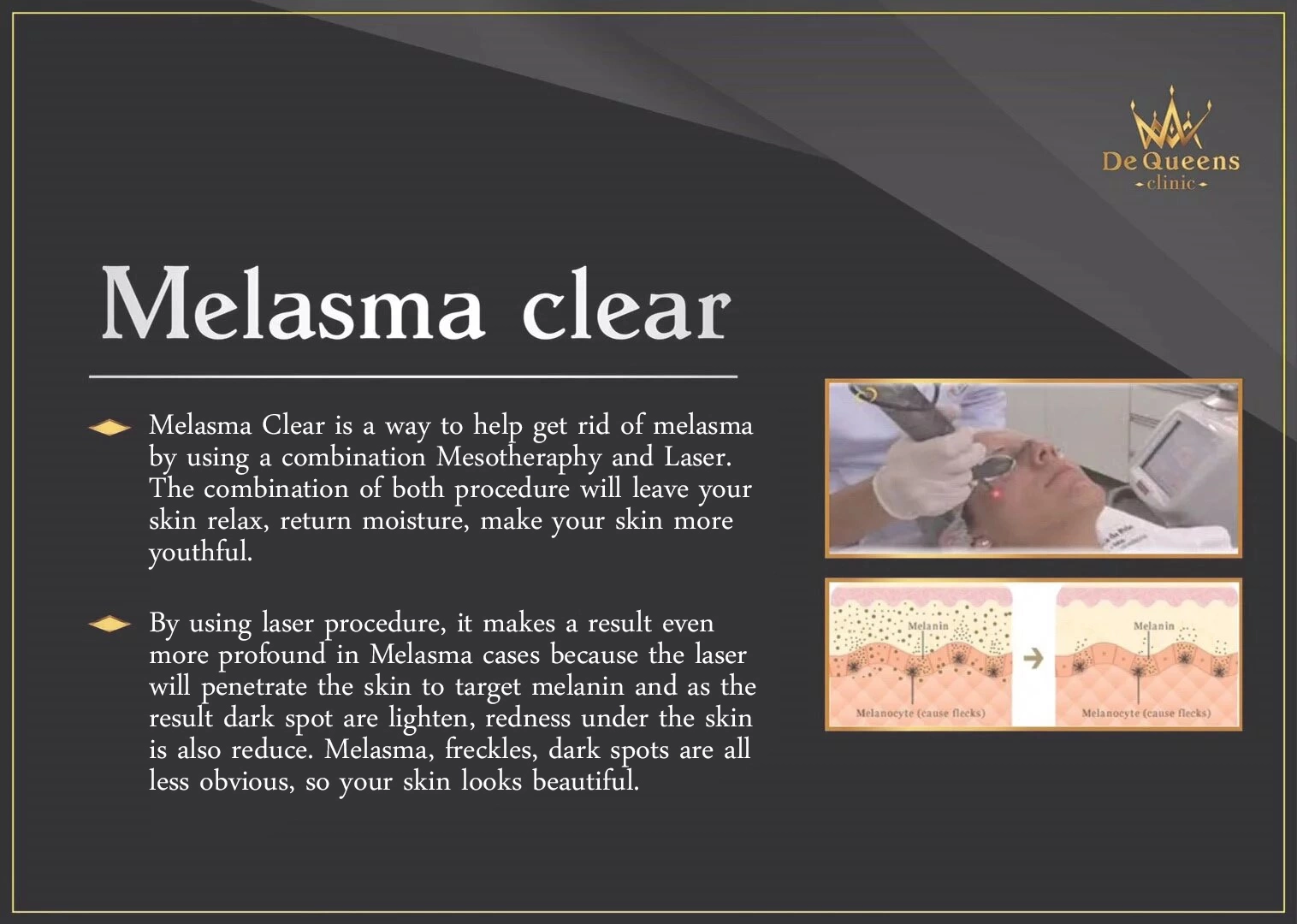 Melasma clear