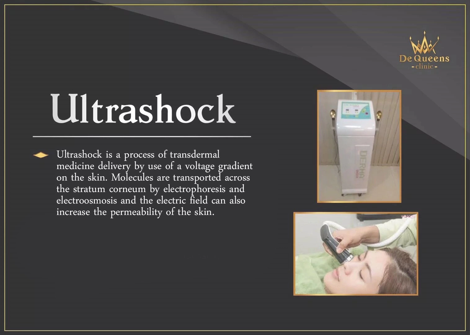 Ultrashock