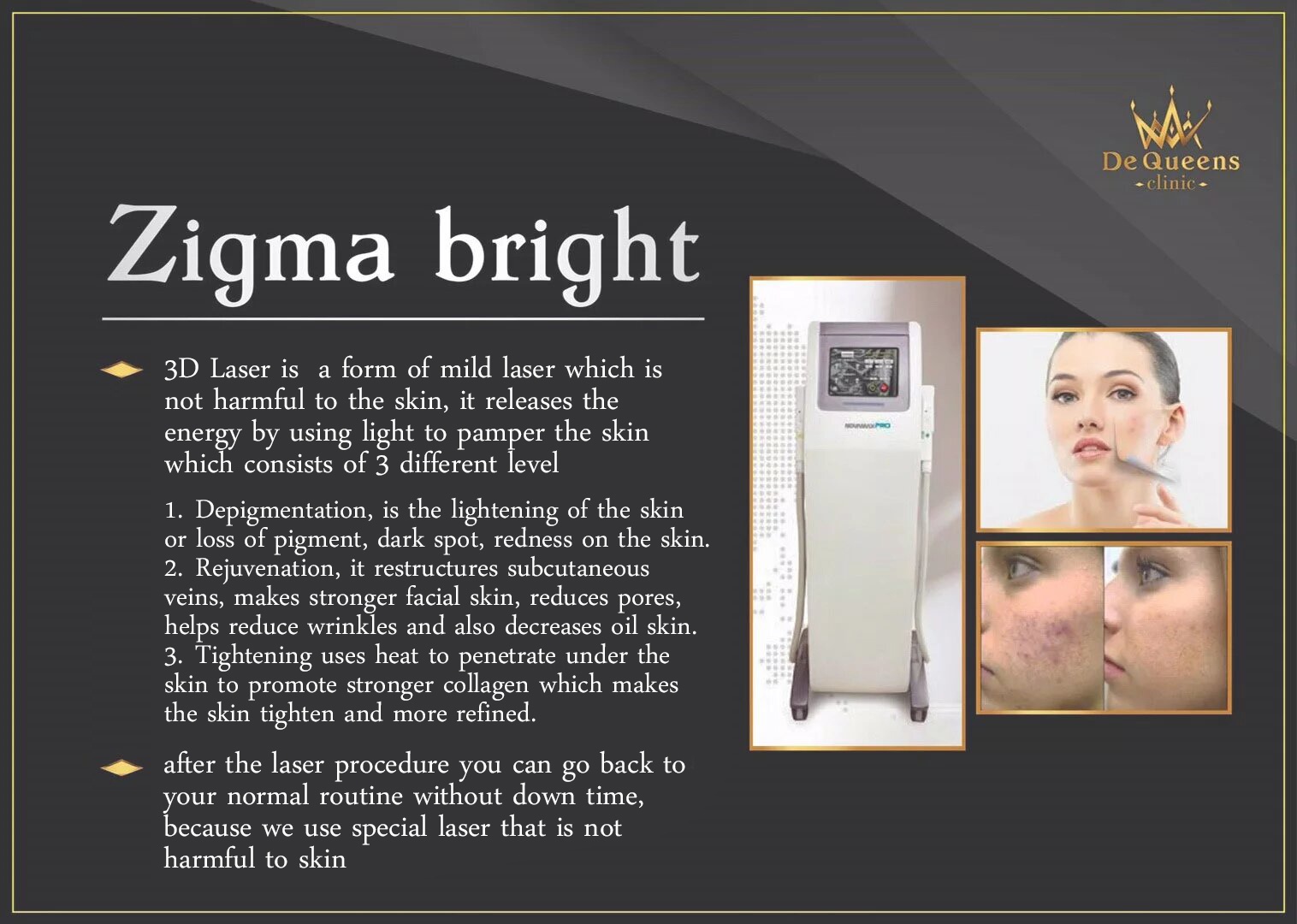 Zigma bright