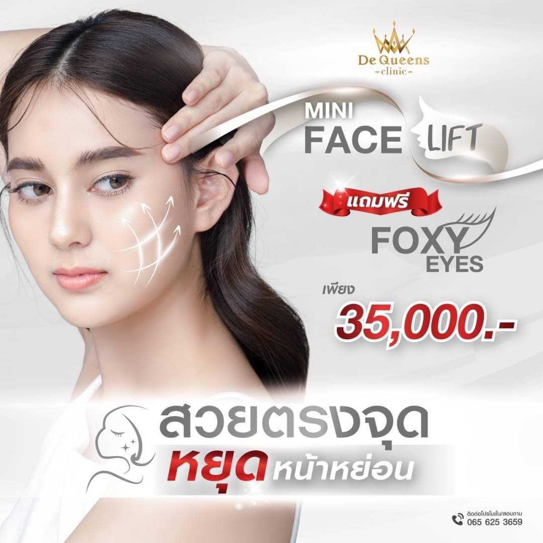 โปรโมชั่นร้อยไหมหน้าเด็ก Mini Face Lift