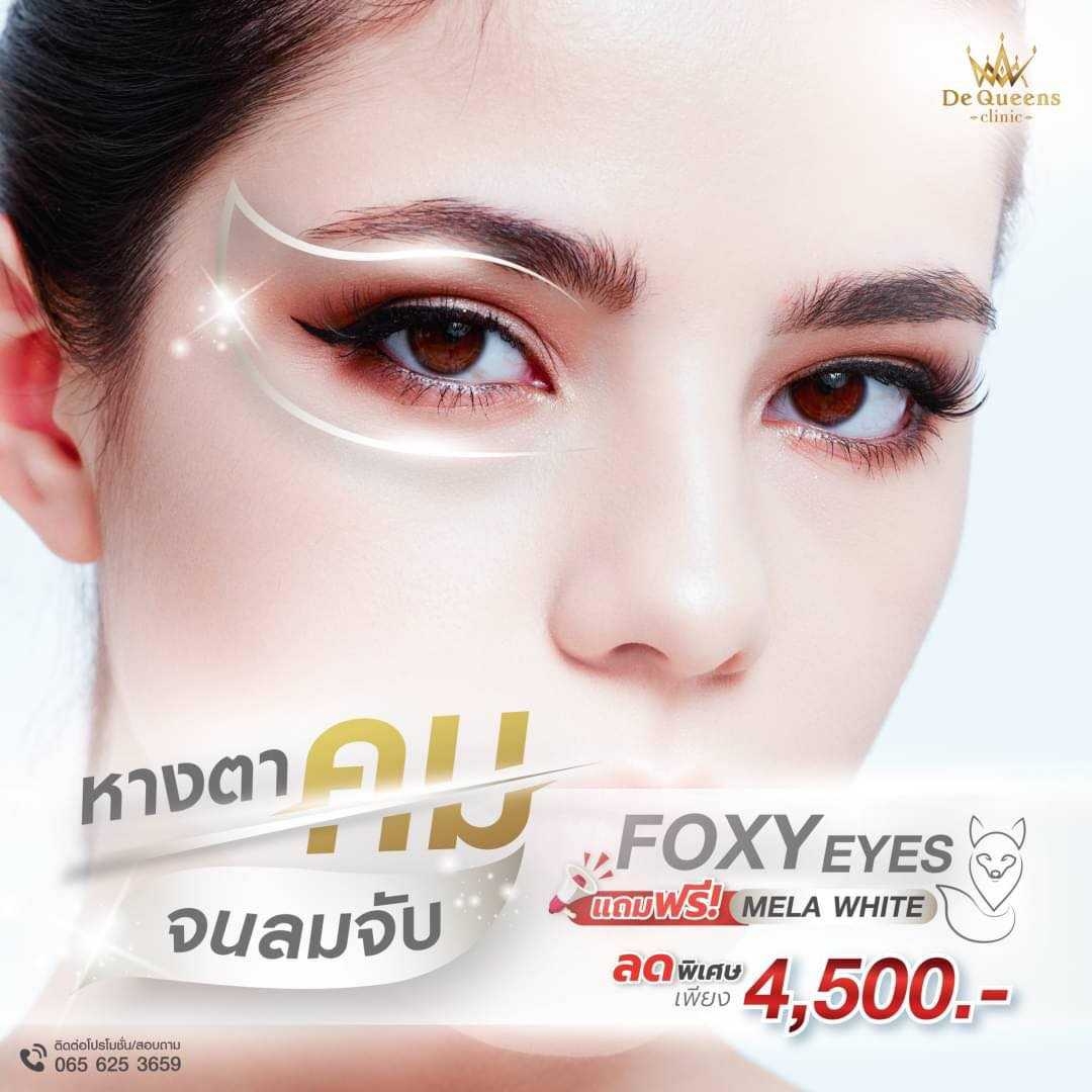 ร้อยไหมหางตา แถมฟรี Botox ลดริ้วรอย
