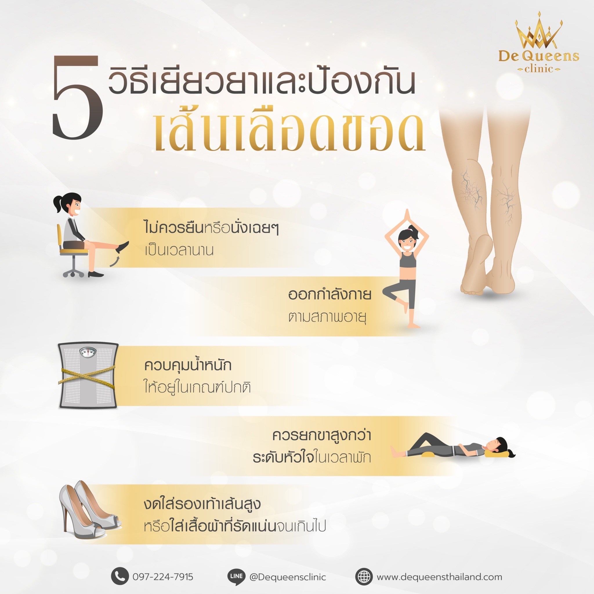 5 วิธีป้องกันเส้นเลือดขอด,เส้นเลือดขอด,รักษาเส้นเลือดขอด