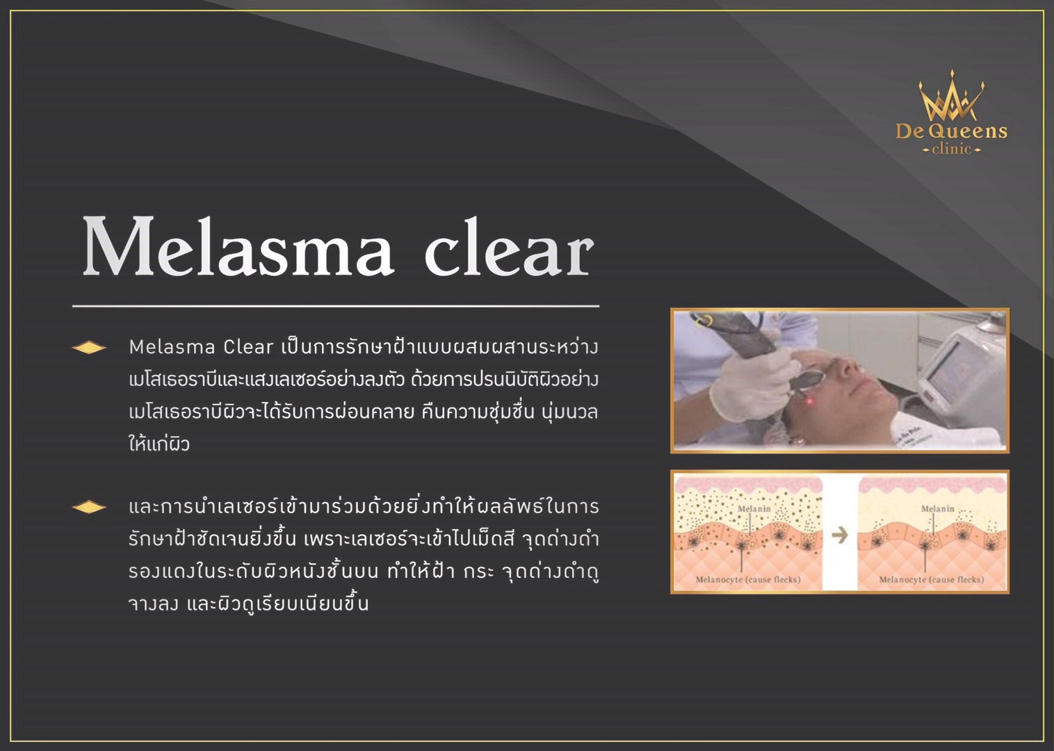 รักษาฝ้า Melasma Clear